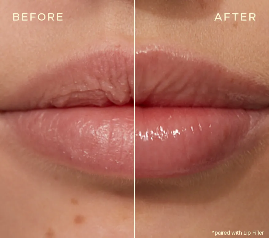 The Lip Plumping and Enhancing Regimen